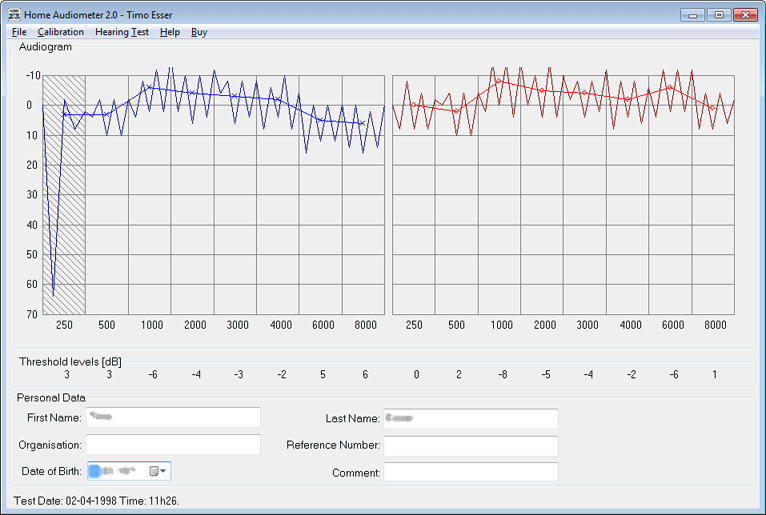 Home Audiometer Hearing Test Windows Software